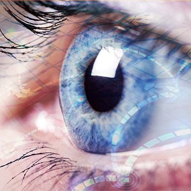 glaucoma