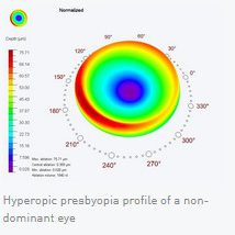 presbymax